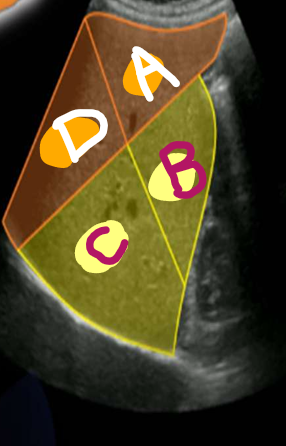<p>D</p>