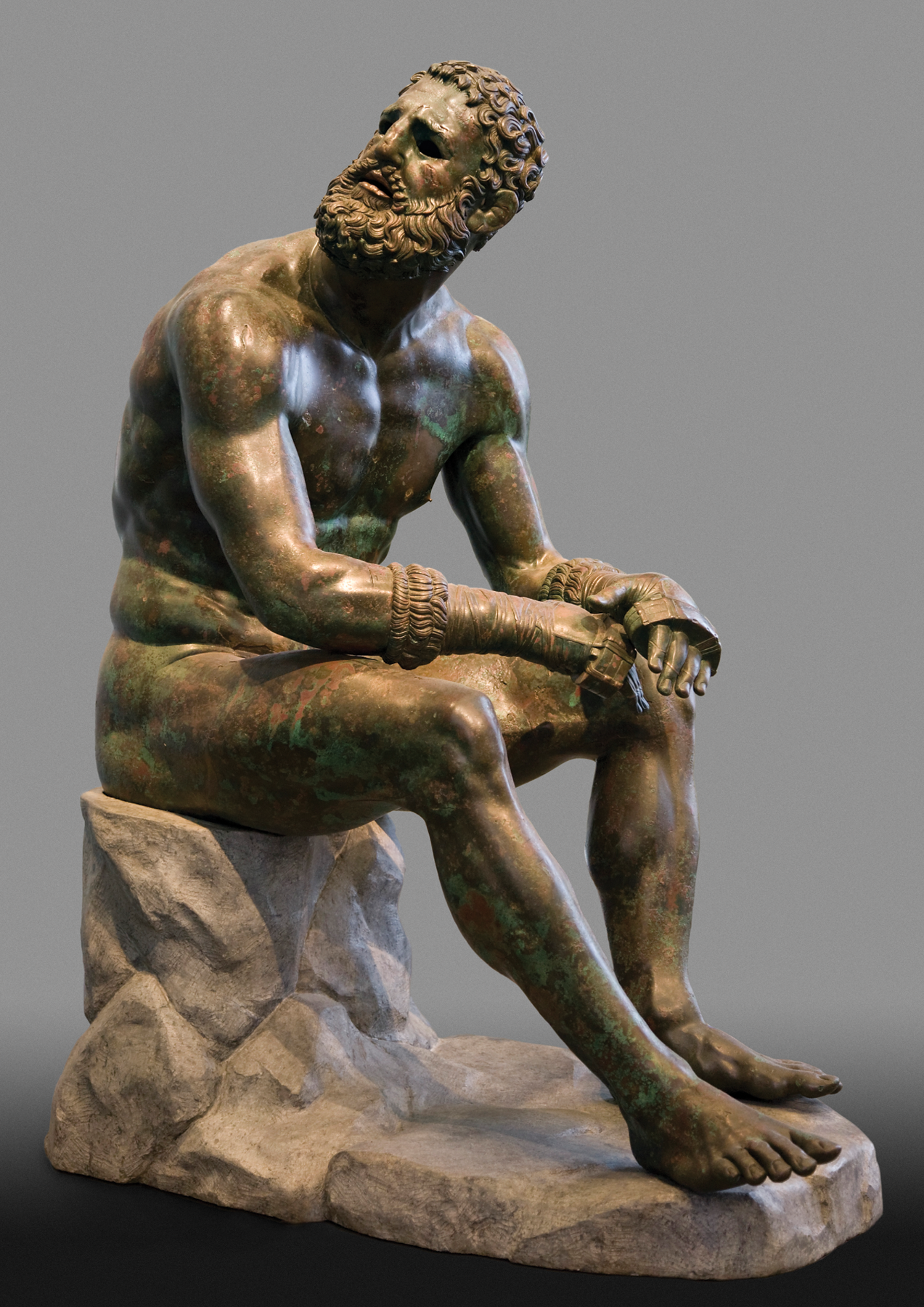 <p>The seated boxer was created using which of the following techniques?<br>A. Lost-wax casting to mold bronze into a hollow form of the figure<br>B. Applying thin sheets of metal to a wooden core carved in the shape of the figure<br>C. Molding metal into a solid form in the shape of the figure, then adding enamel<br>D. Hammering a sheet of bronze into the shape of the figure, then inlaying gold details</p>