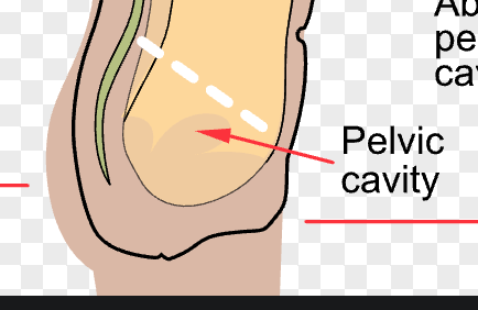 <p>pelvic cavity</p>