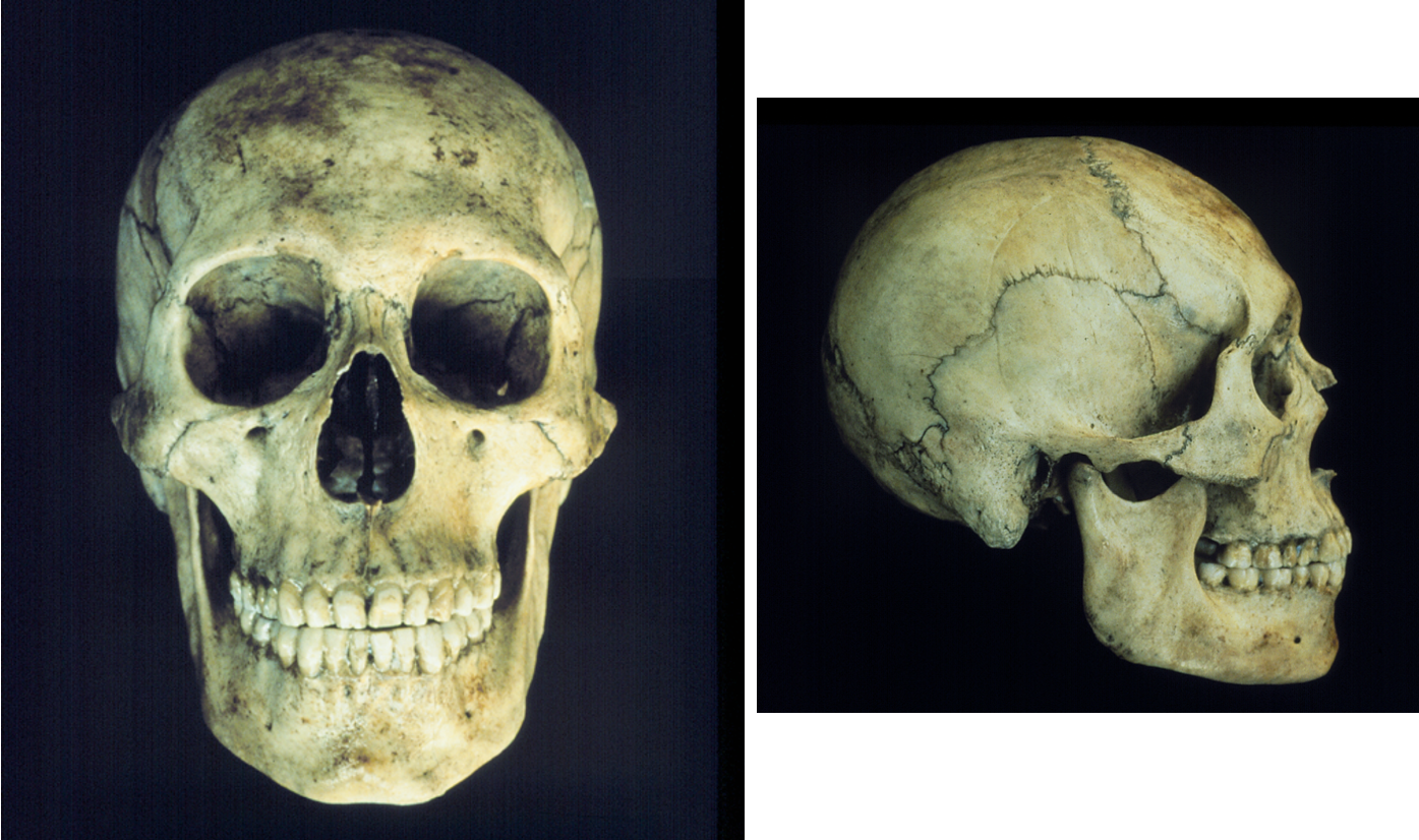 <p>Of what ancestry is this skull?</p>