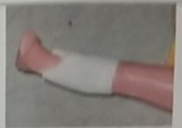 <p>Delvit Cast </p>