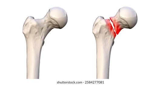 <p>location of break</p>