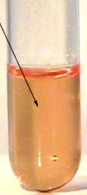 <p>Is this a positive or negative Urease test?</p>