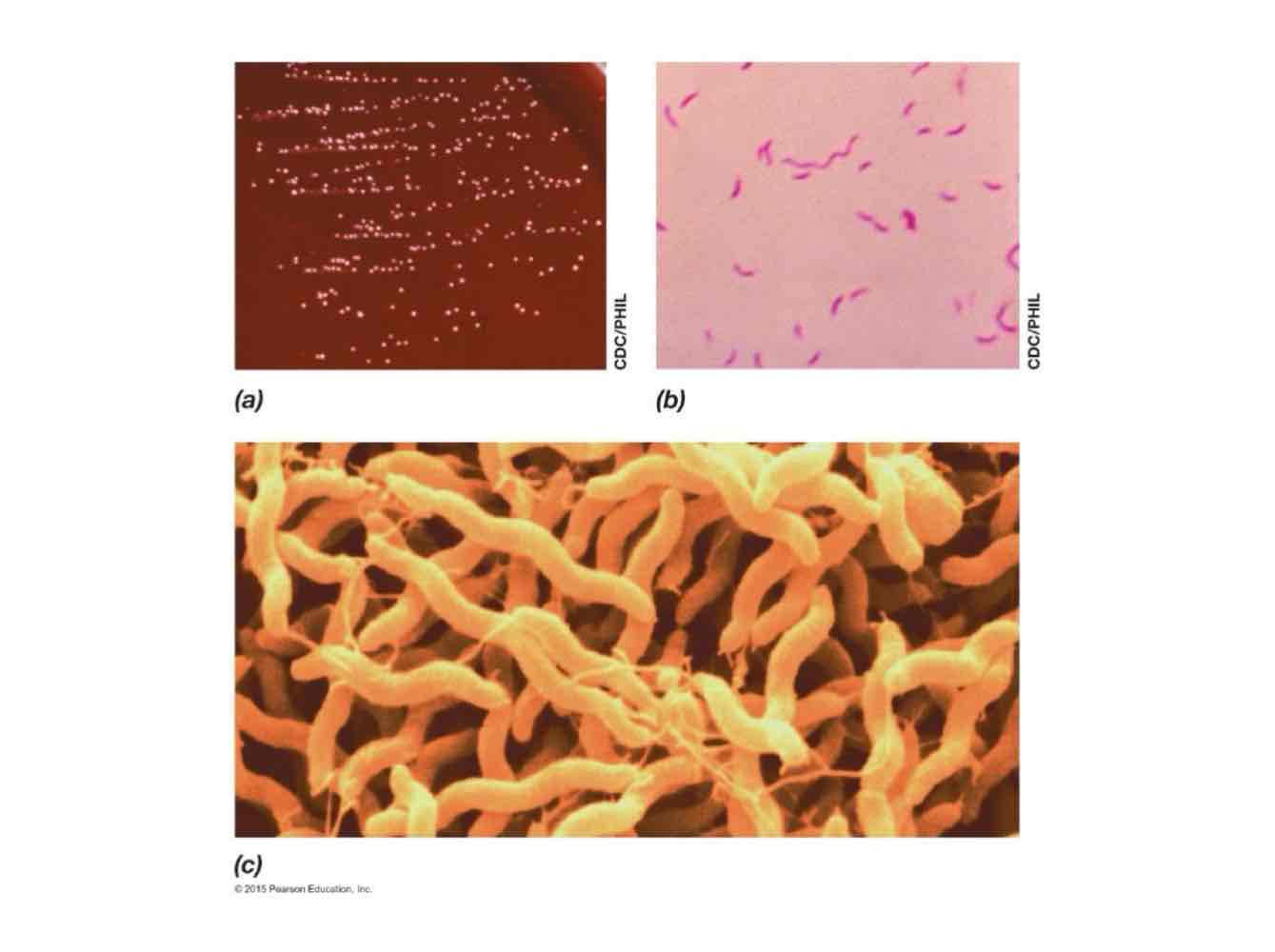 <p><em>Campylobacter jejuni</em> is frequently transmitted in under-cooked chicken and causes food-borne illnesses like gastroenteritis and bloody diarrhea.</p>
