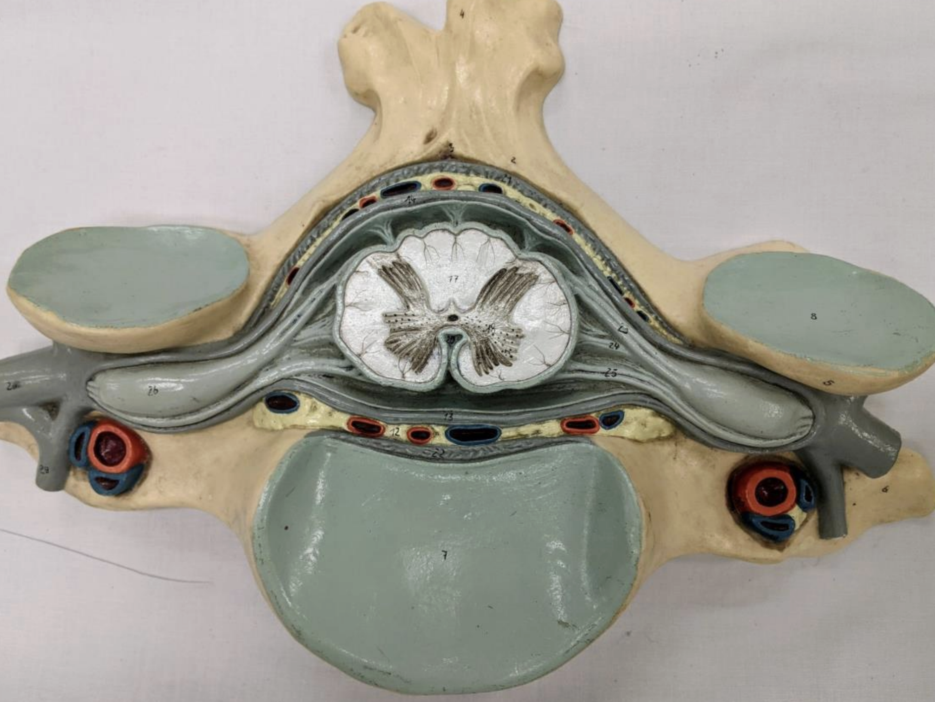 <p>3 meninges: </p><ul><li><p>Dura mater</p></li><li><p>Arachnoid mater</p></li><li><p>Pia mater</p></li></ul><p></p><p>Epidural </p><p></p><p>Subarachnoid spaces</p><p></p>
