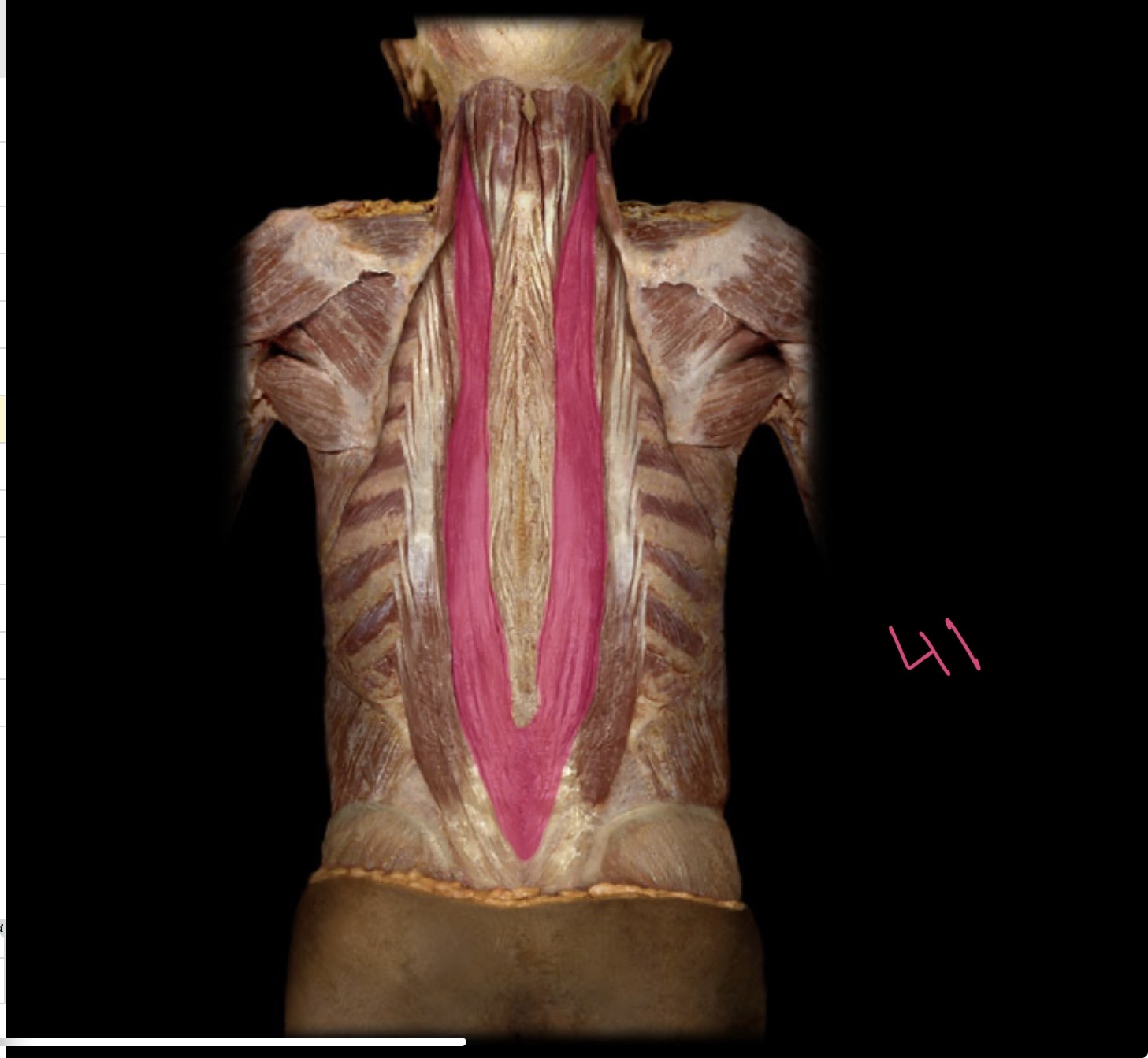 <p>Longissimus</p>