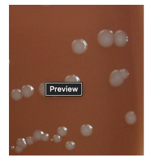 <p>A sputum culture grows 2+ normal respiratory flora on the BAP and CHOC agar at 24 hours.&nbsp; It also grew 3+ colonies on the CHOC, but <em>not</em> on the BAP or MAC agar.&nbsp;&nbsp;</p><p>The colonies on CHOC are small to medium, tan and smooth.&nbsp; There is a mousy odor.&nbsp; A magnified image is seen below:</p><p></p><p>GS = GNCB</p><p>OX= neg/slow positive</p><p>The most likely identification of this isolate is:</p><p>&nbsp;</p><p>Haemophilus spp.</p><p>&nbsp;</p><p>Francisella spp.</p><p>&nbsp;</p><p>Burkholderia spp</p><p>&nbsp;</p><p>Pseudomonas spp.</p>