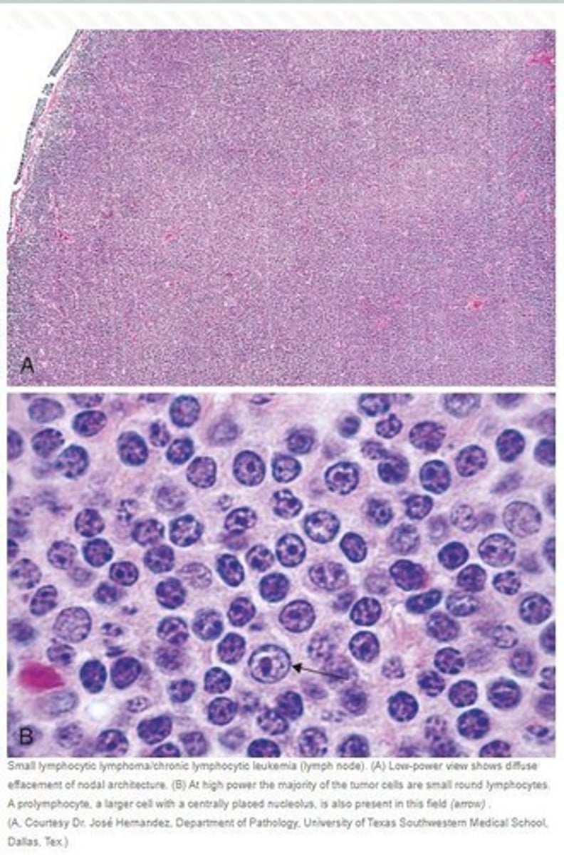 <p>CD19, CD20, CD 23 and CD5.</p>