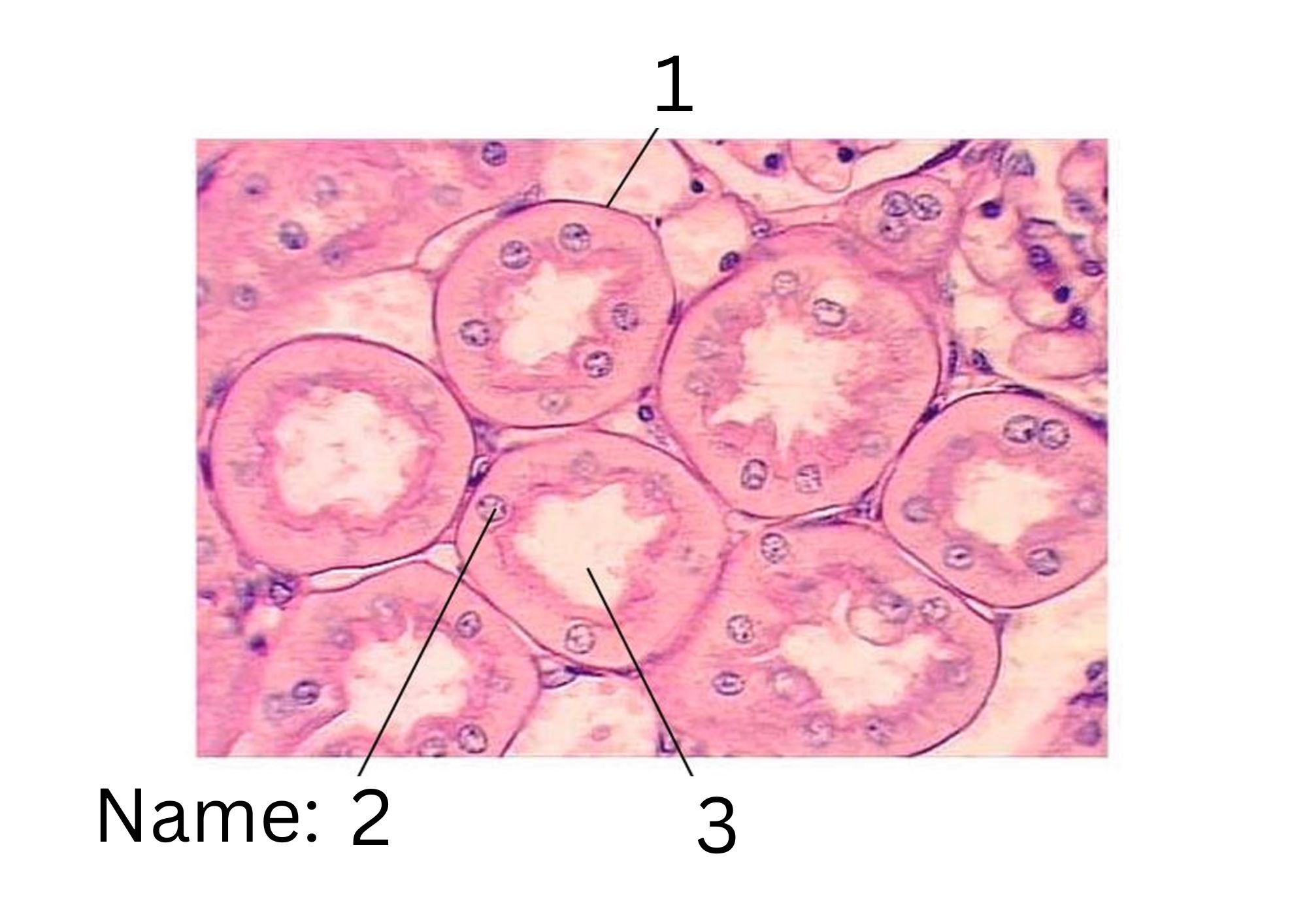 term image