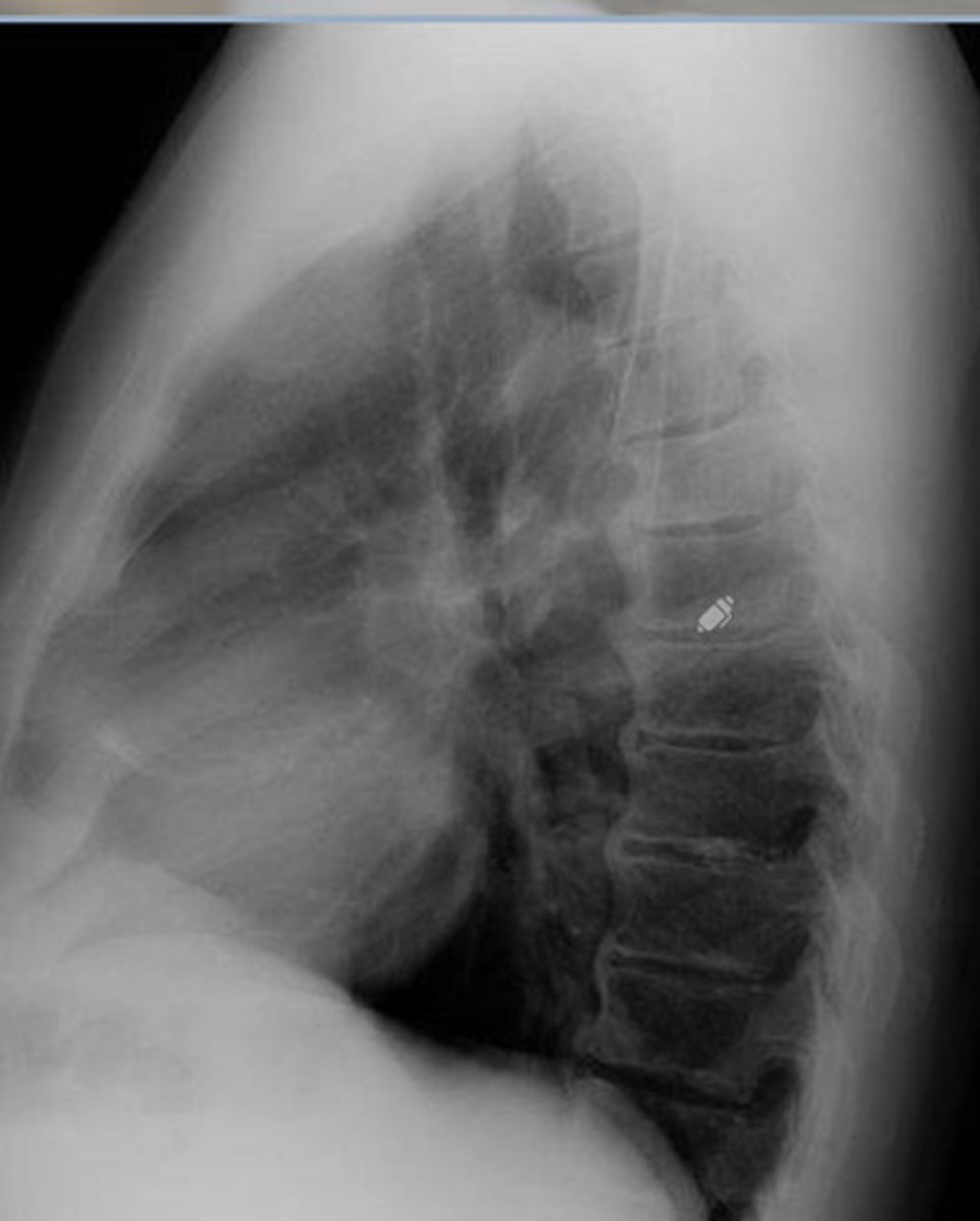 <p>What is wrong with this image?</p>