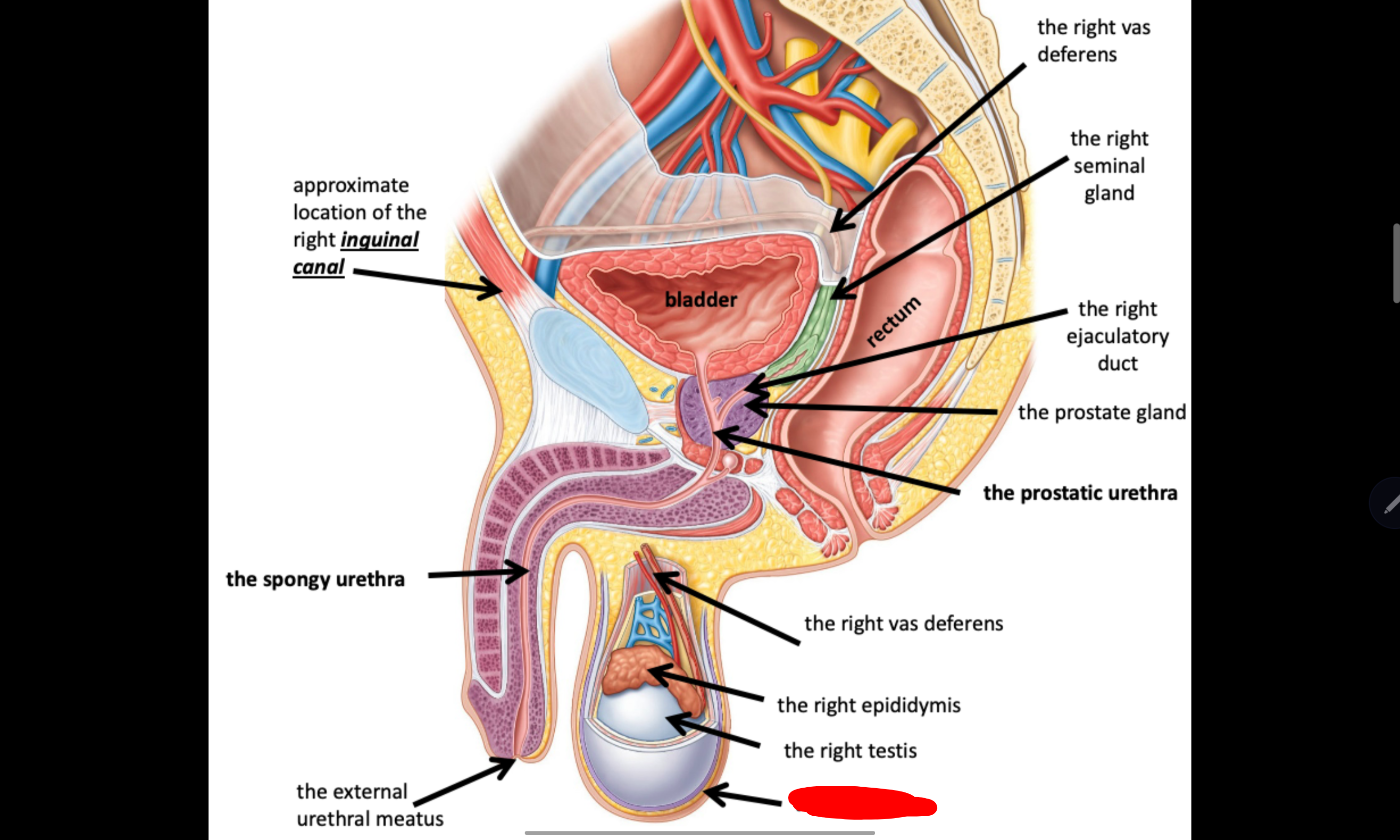 <p>Name the structure in red</p>