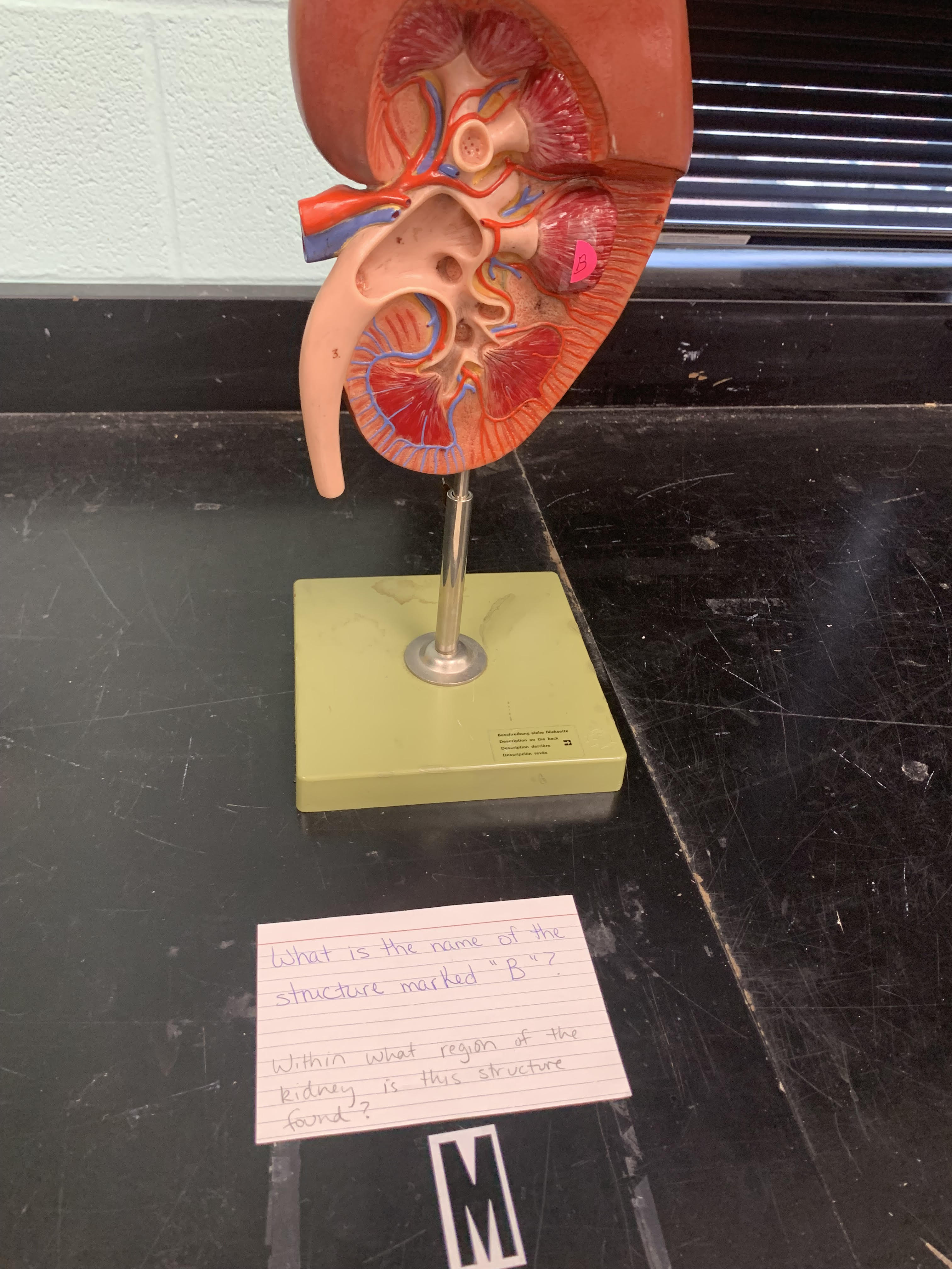 <p>Within what region of the kidney is this structure B found?</p>
