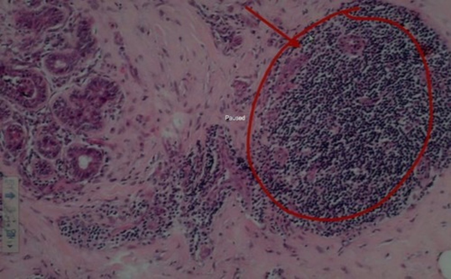 <p>the amount of material in something.</p>