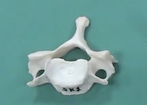 <p>What region of the vertebrae is this:</p><img src="blob:null/19960bba-60a9-4aee-aa03-5f7120e5163e"><p></p>