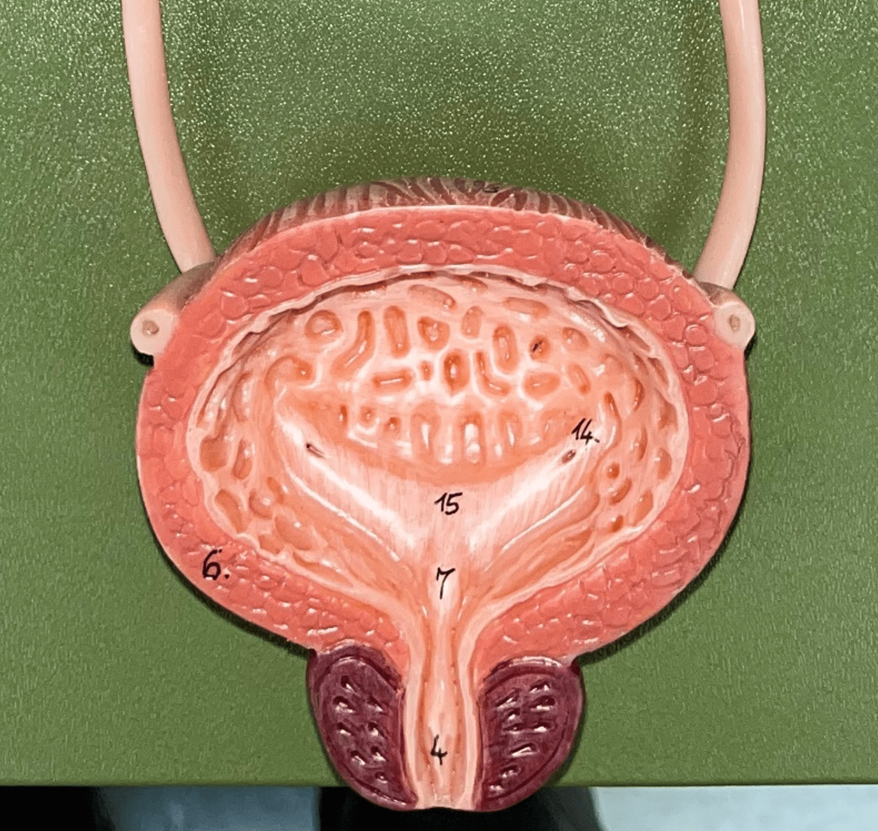 The hollow sac organ that collects and temporarily stores urine.