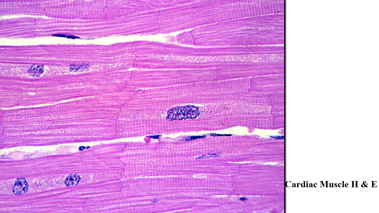 <p>Cardiac muscle – LM – H&E</p>