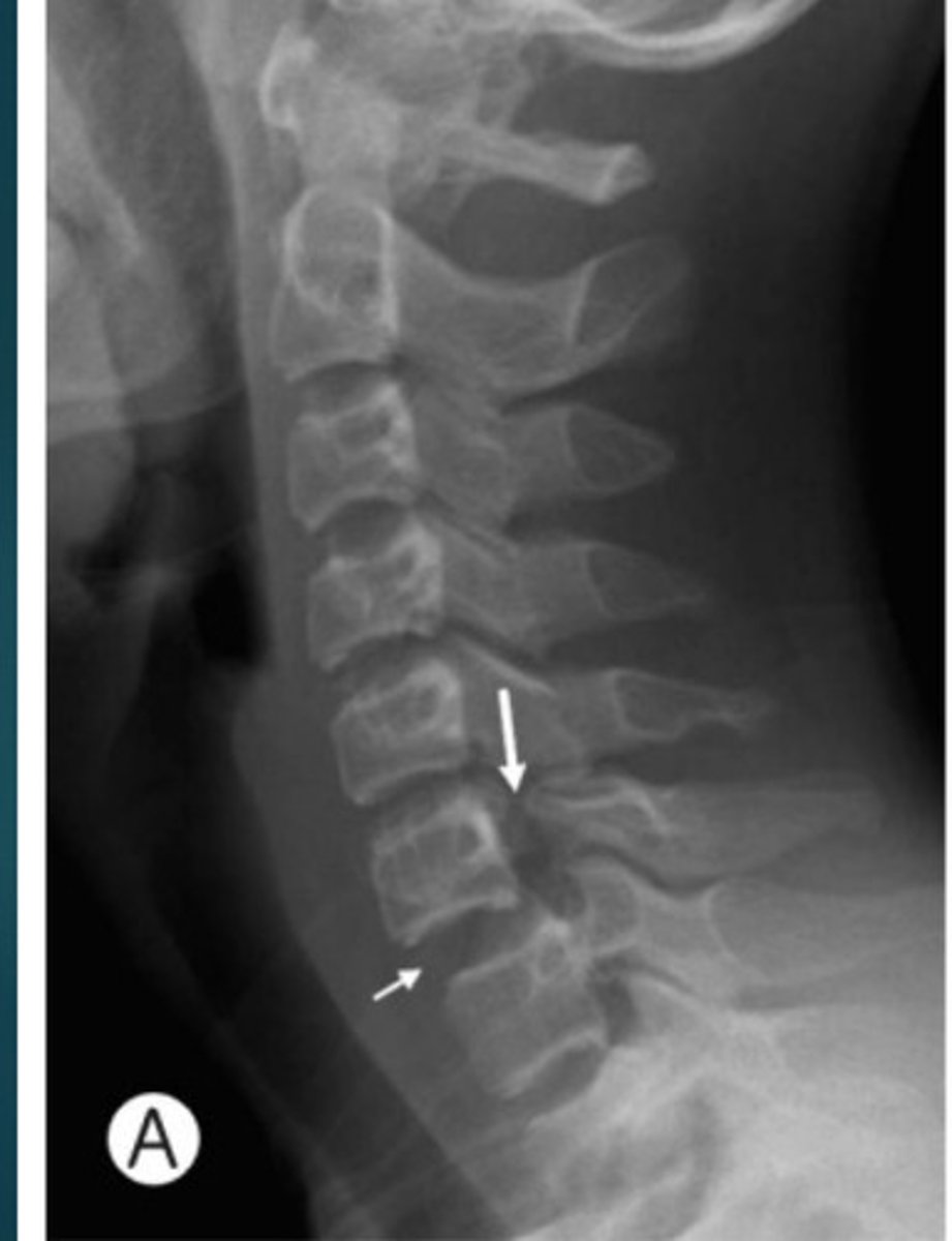 <p>What condition is this?</p>