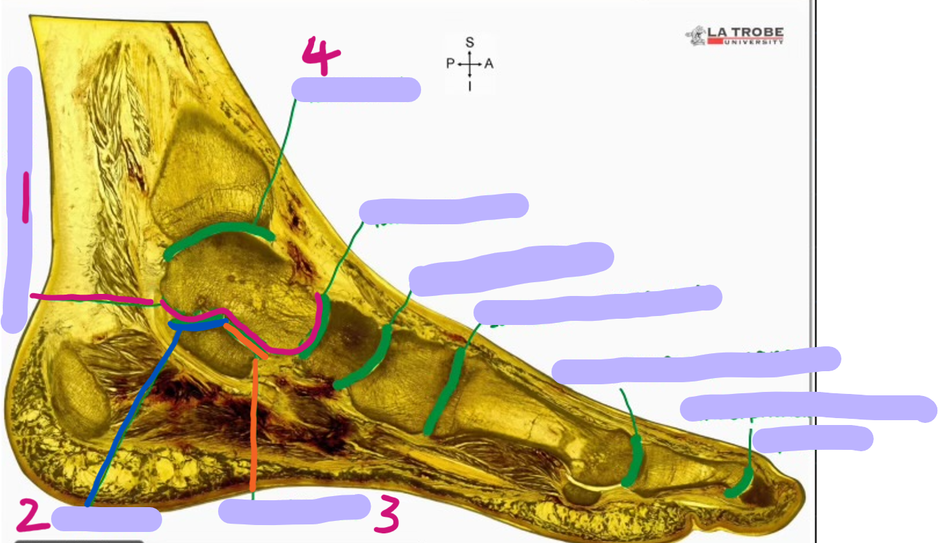 <p>identify these joints</p>