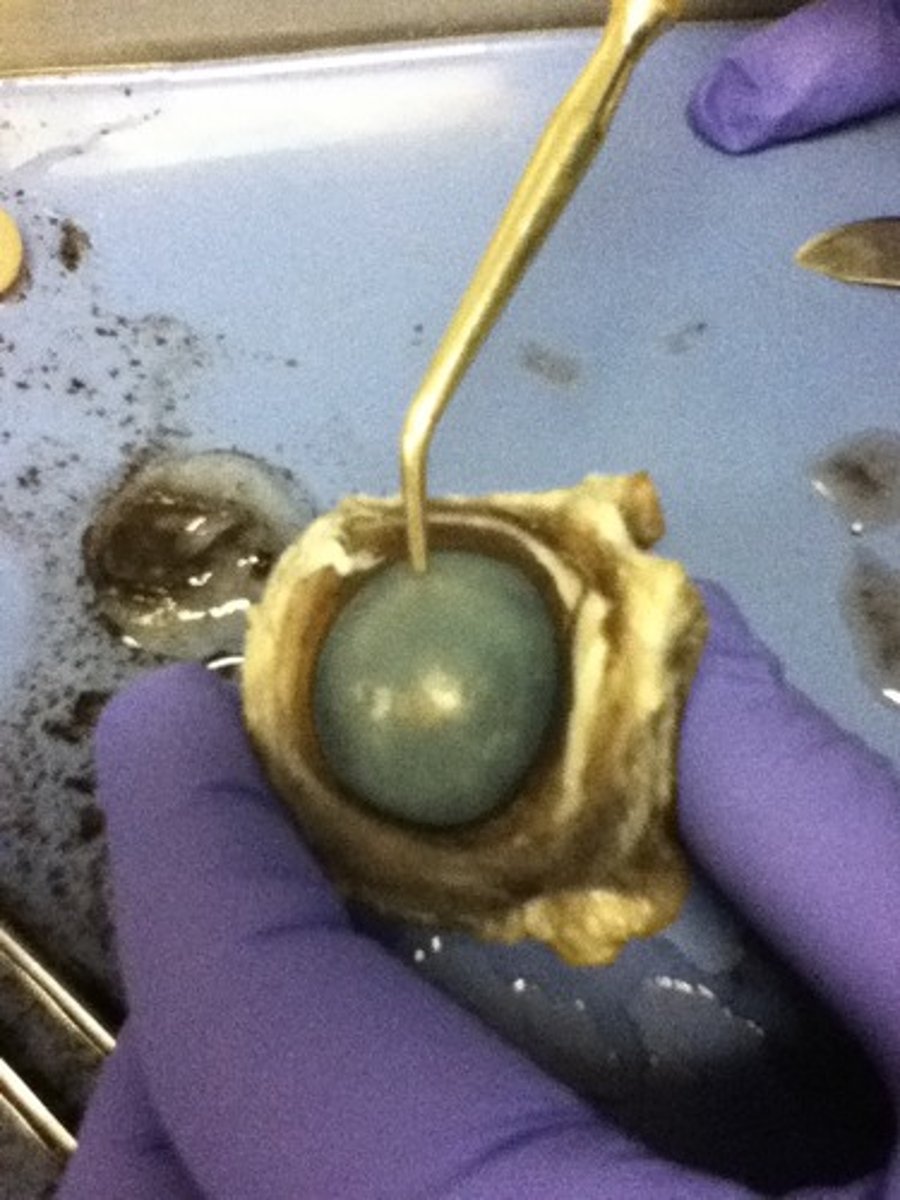 <p>-A tough, clear covering over the iris and the pupil that helps protect the eye.<br>-Light bends as it passes through the cornea.<br>-The cornea begins bending light to make an image; the lens finishes the job.</p>