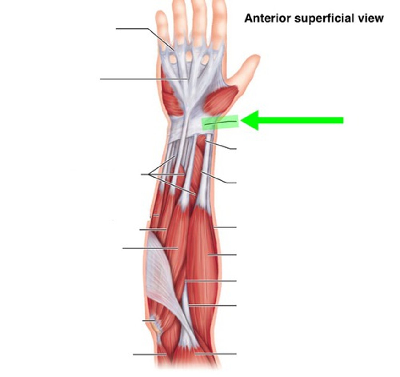 <p>anterior wrist ligament that holds wrist flexor tendons close to the wrist when the wrist flexes</p>