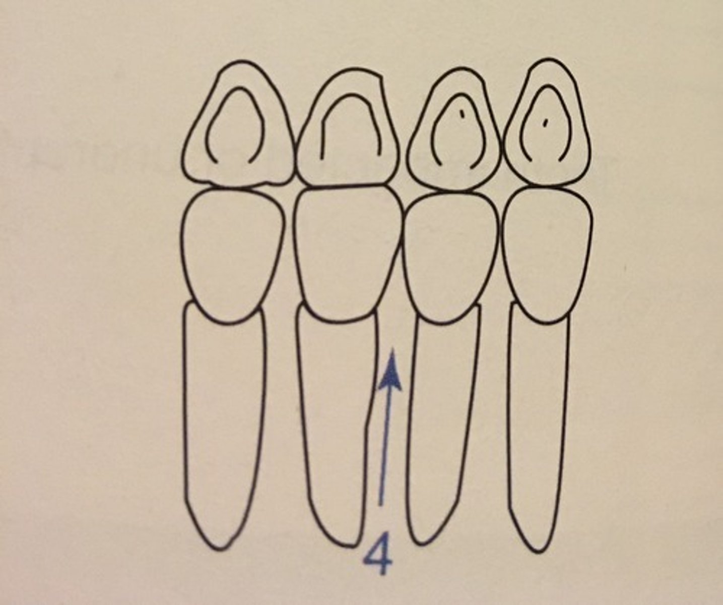 knowt flashcard image