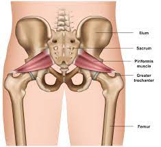 <p>Hip/Thigh Muscle Location:</p>