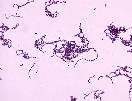 streptococcus pyogenes