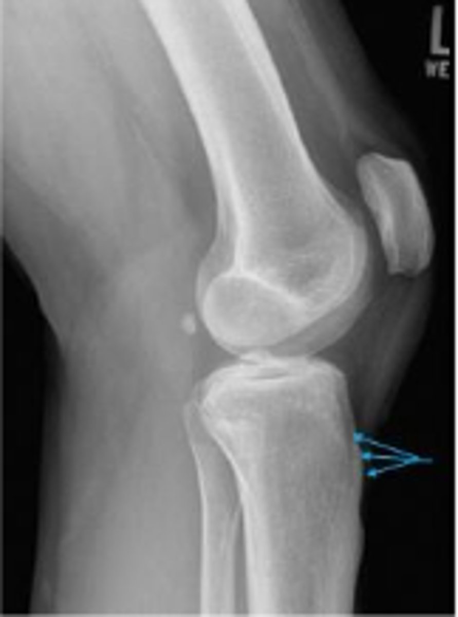 <p>What are the arrows pointing to?</p>