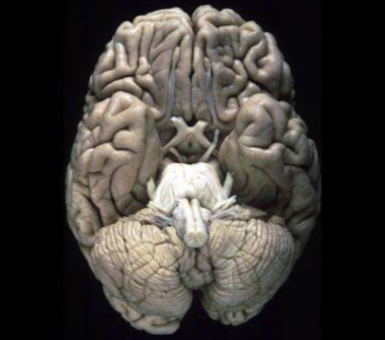 <p>What view of the brain is this?</p>