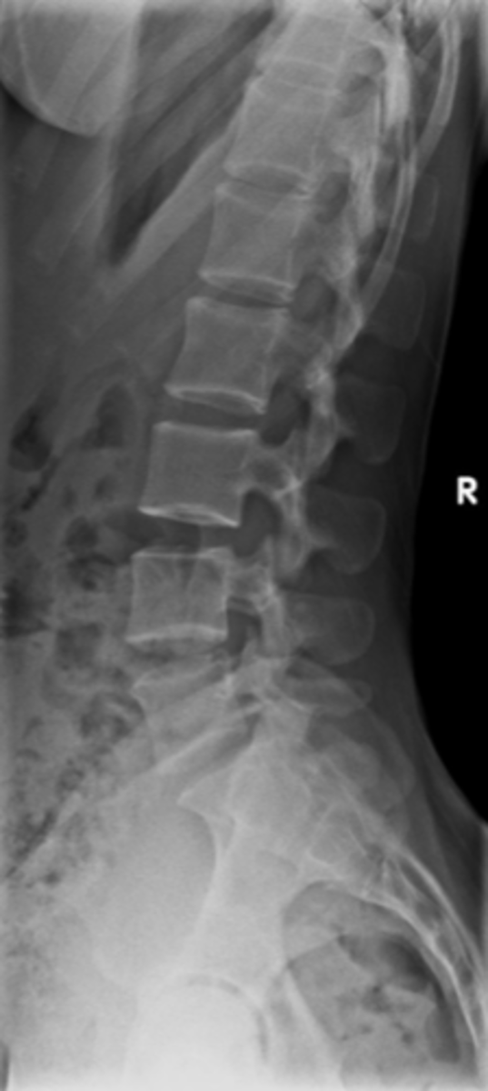 <p>ID view</p>