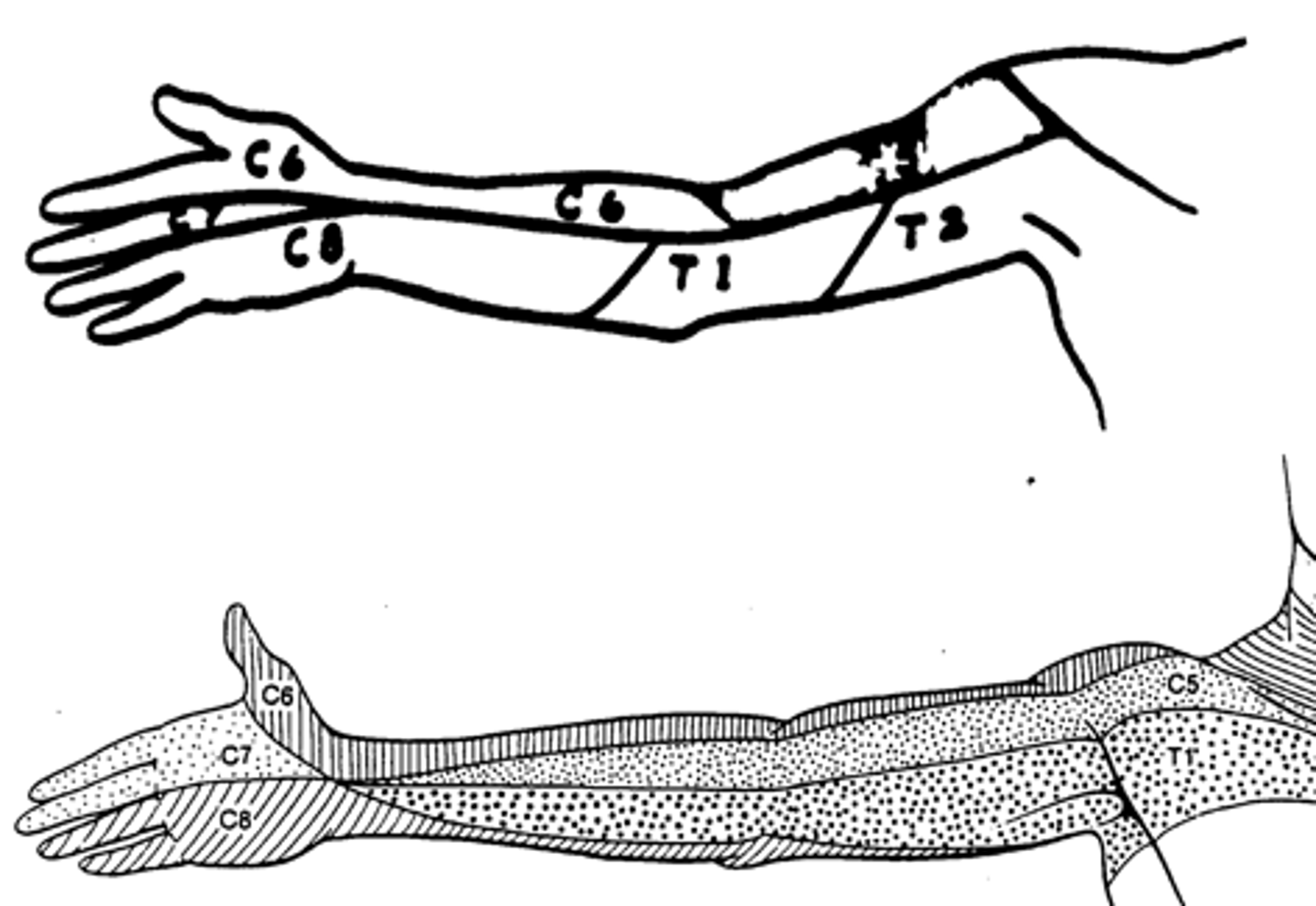 <p>In anatomical position, the lower middle portion of the anterior arm near the elbow, possible extending medially into the pectoral region.</p>