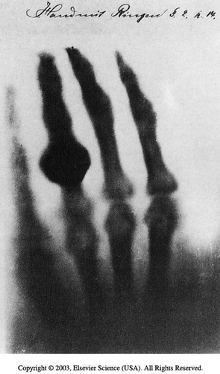 <p>Wilhelm Conrad Röentgen produced the first x-ray image on November 8, 1895.</p>