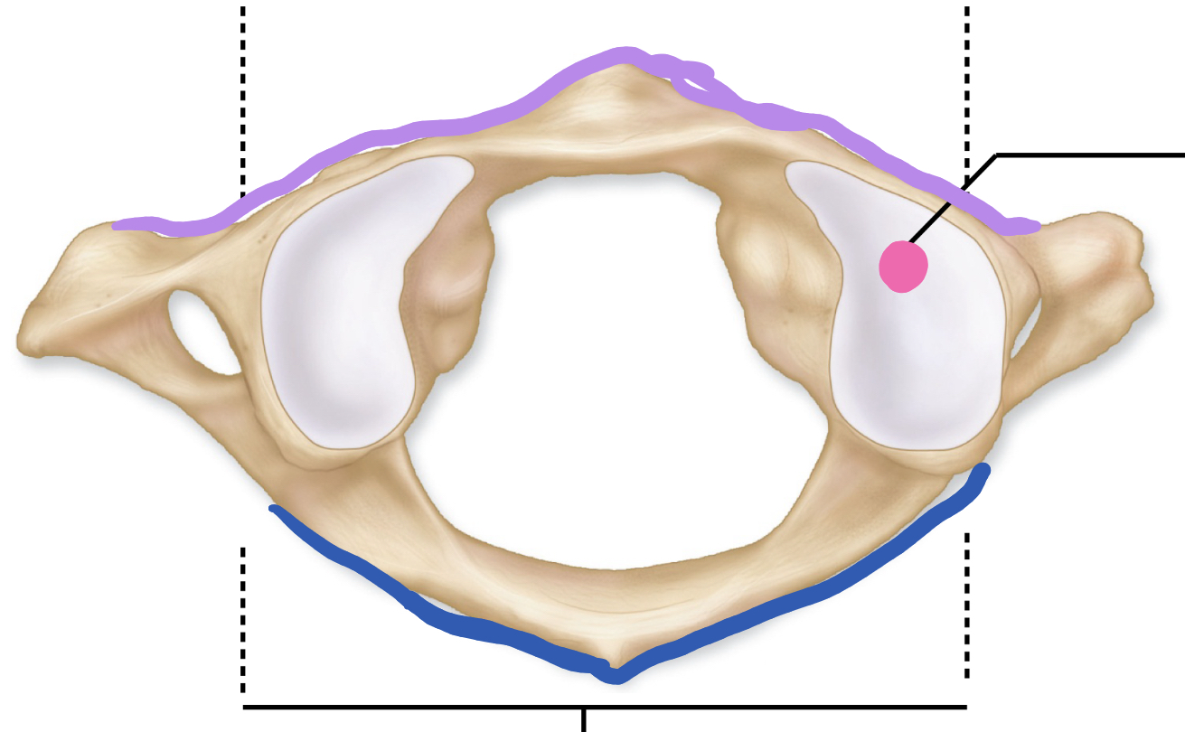 <p>What is the purple arch?</p>