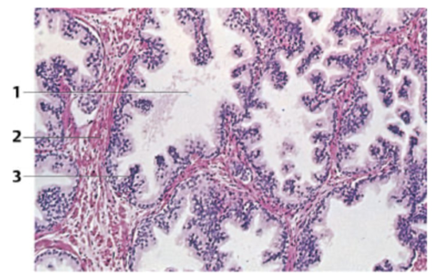 <p>A 62-year-old man presents with urinary hesitancy, weak stream, and incomplete emptying. The organ responsible for the symptoms in the patient was surgically removed via a transurethral approach. A biopsy from the specimen is seen in the figure. </p><p>What organ does this biopsy come from?</p>