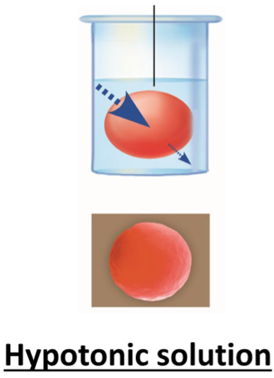 <p>hypotonic solution </p>