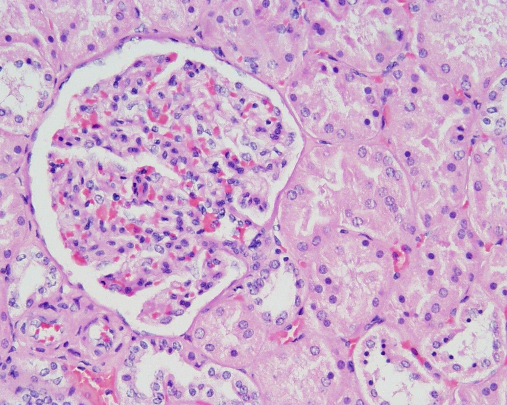 <p><strong>Name the 2 tissue types?</strong></p>