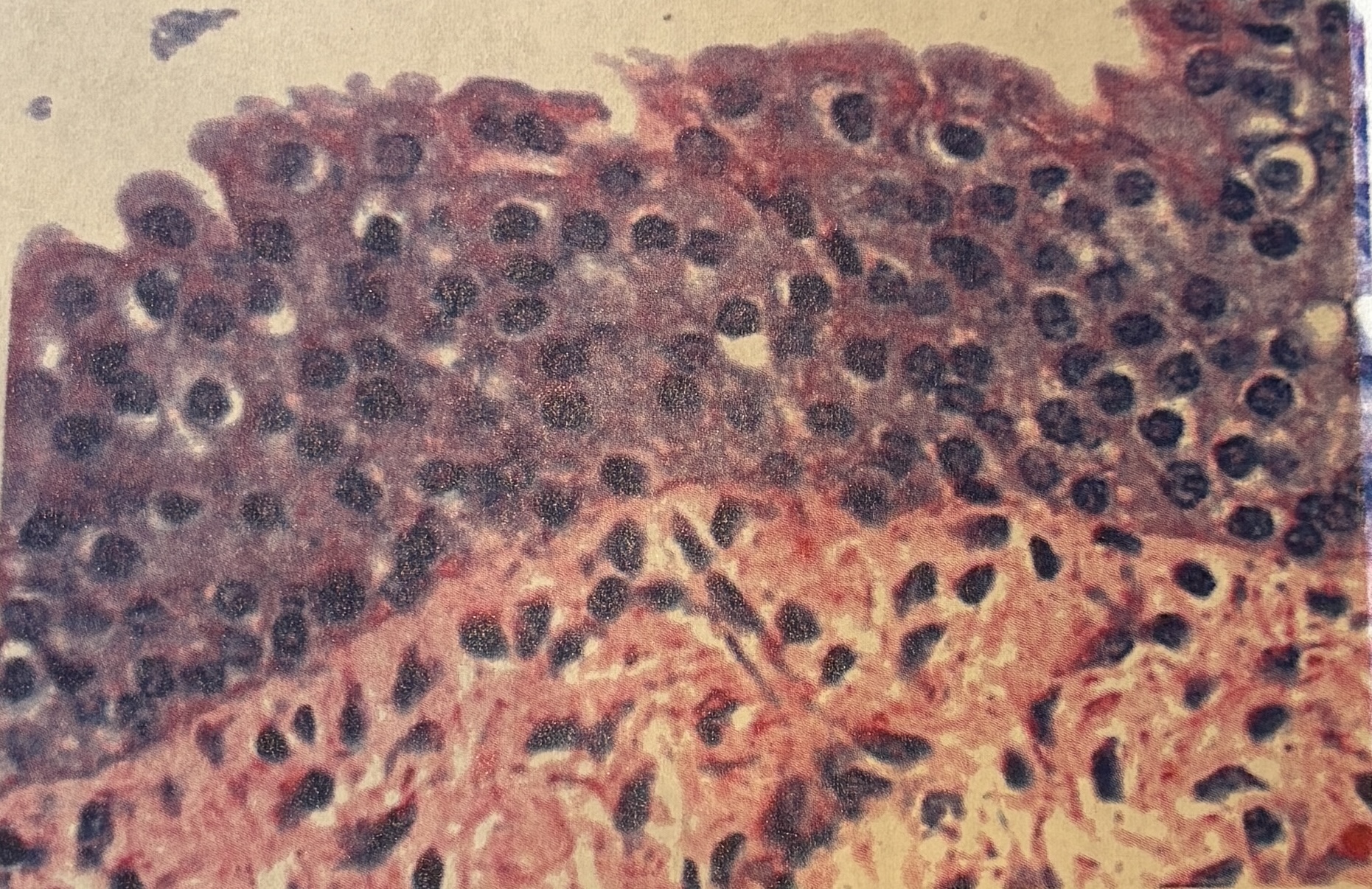 <p>transitional epithelium- functions + location</p>