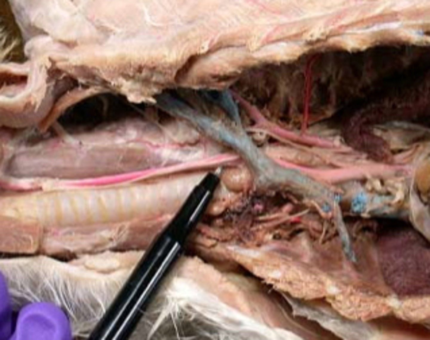 <p>nerve, seen innervating the heart</p>