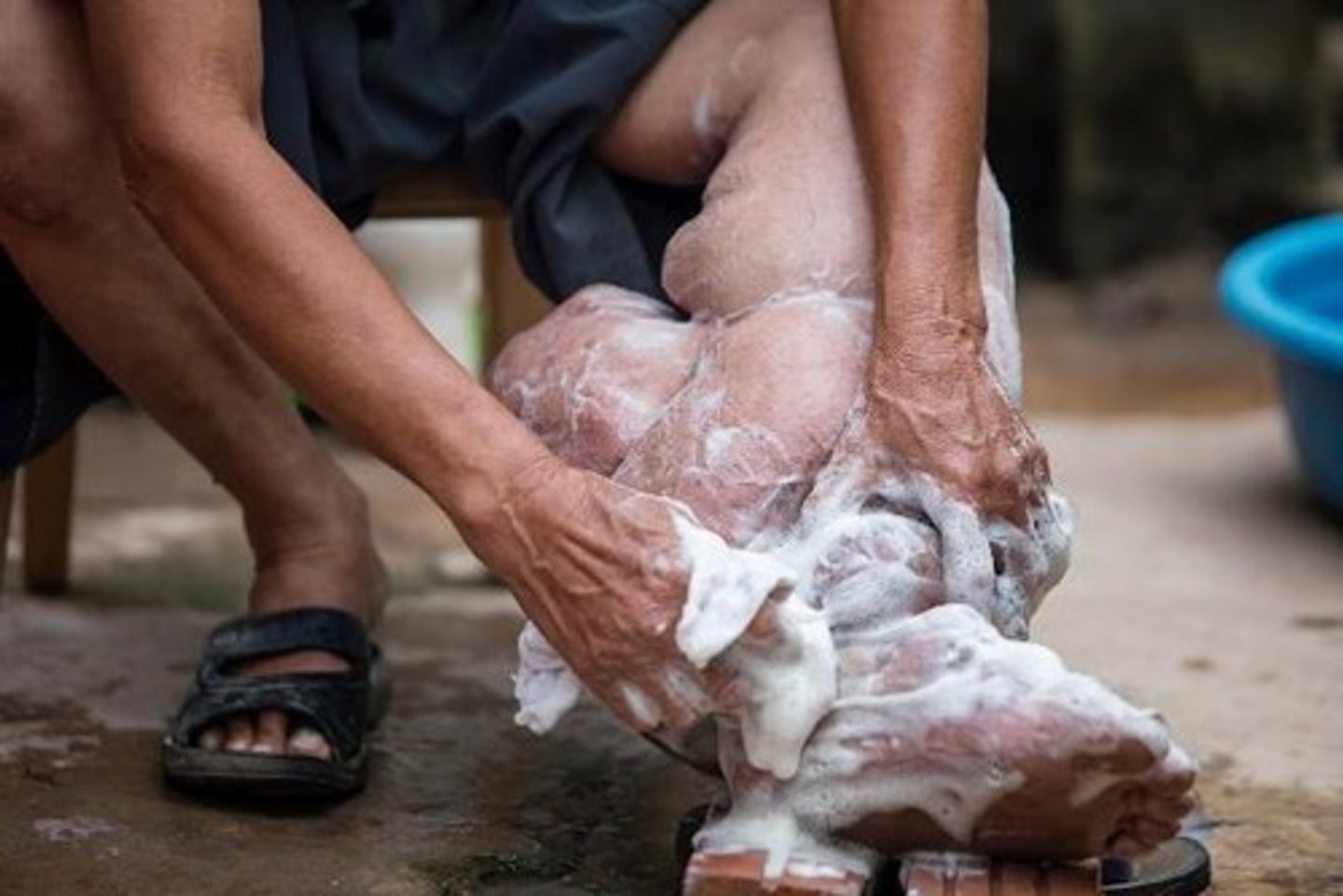 <p>Use of properly treated water for consumption, boiling water suspected of contamination.</p>