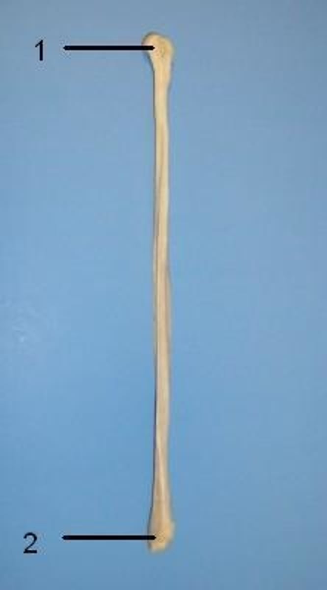 <p>ID bone</p>