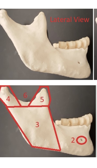 <p>6) name this indention </p>