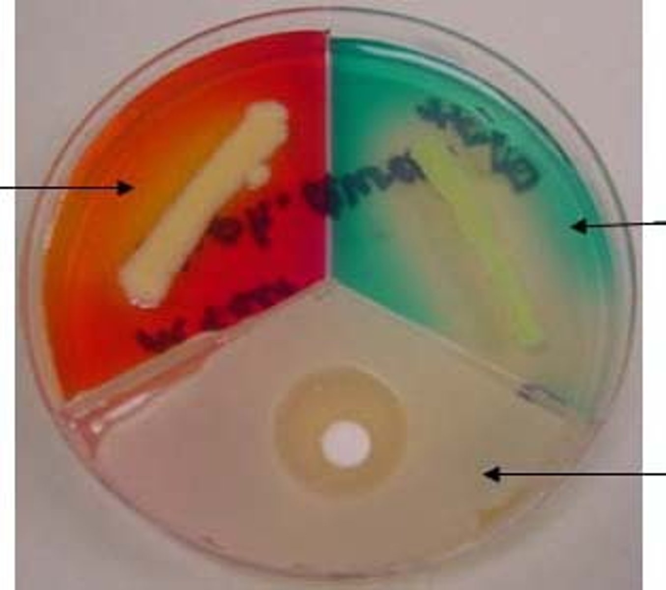 <p>Staphylococcus tri-plate</p><p>-DNase (blue-green)</p><p>-Mannitol Salt agar (pink)</p><p>-Mueller-Hinton Agar (yellowish-clear)</p>