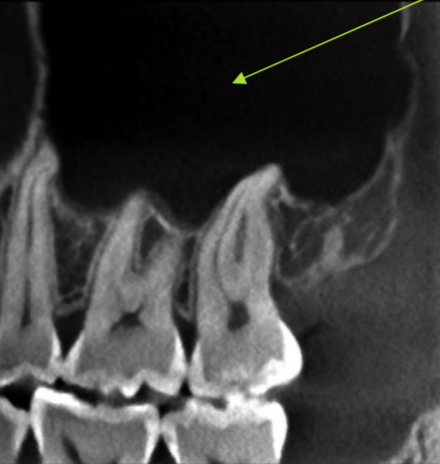 <p>identify the structure </p>