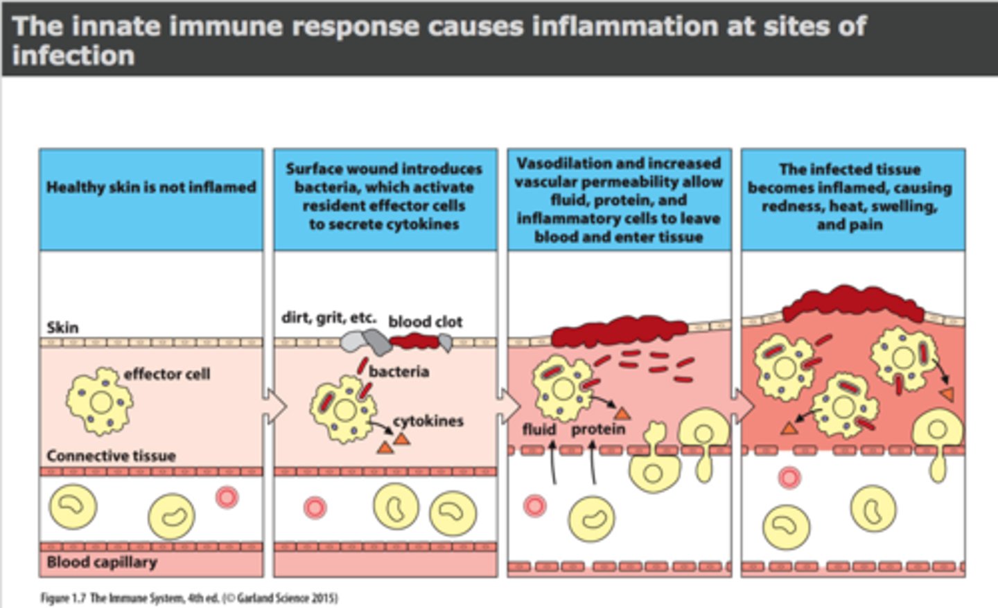 <p>- an innate, non-specific response</p><p>- onset: minutes (acute inflammation)</p><p>- triggered by a noxious stimulus (eg. pathogen, allergen, injury)</p><p>- inflammatory mediators released from tissue cells (as per the noxious stimulus)</p>