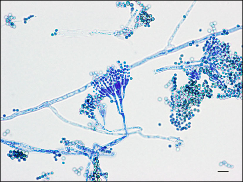 <p>What opportunistic mold looks like a <strong>tulip</strong>?</p>