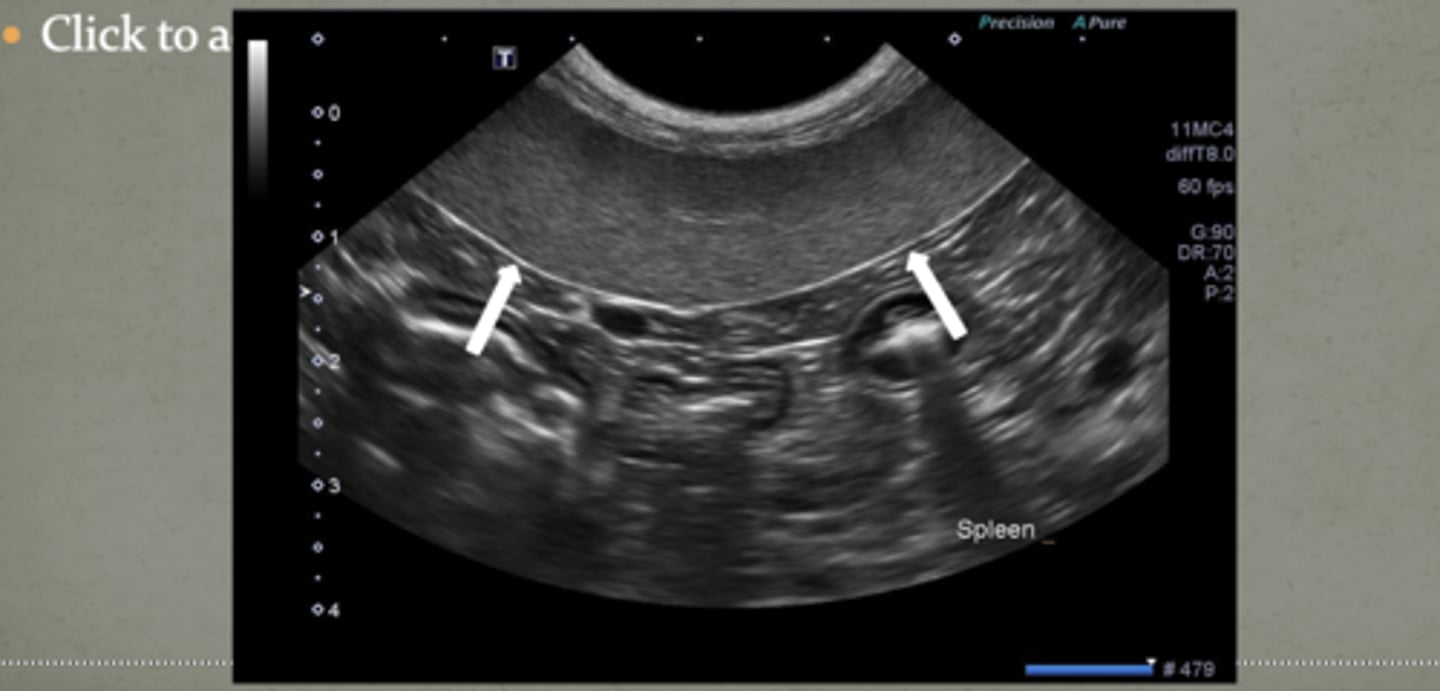 <p>this is the spleen, just know what it looks like!!</p>