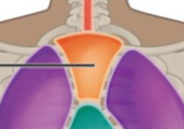 <p>What is the name of this Cavity? What group of cavities do they belong to?</p>