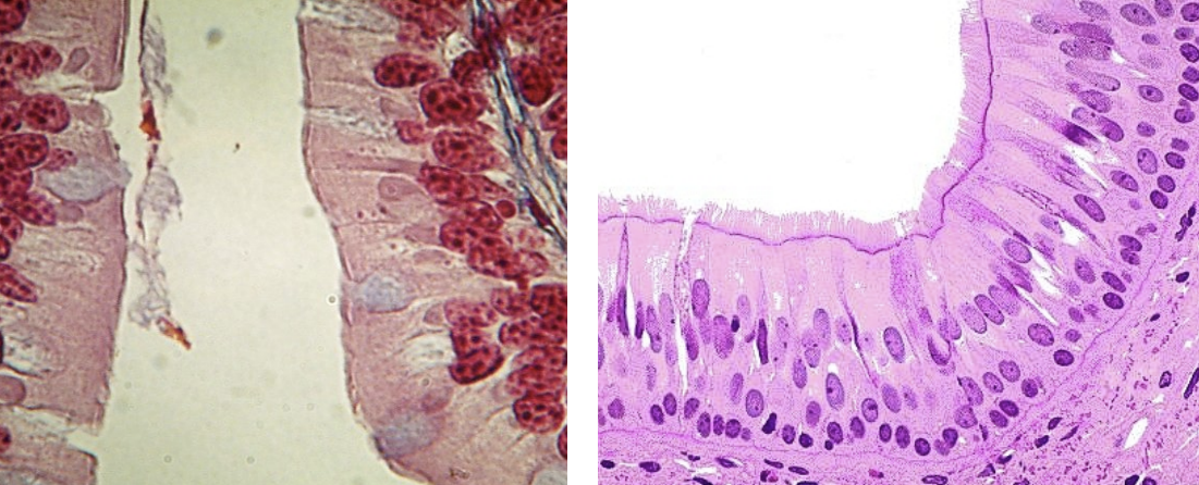<p>Tissue found in the trachea and nasal cavity; functions include movement of fluids (mucus) and protection.</p>