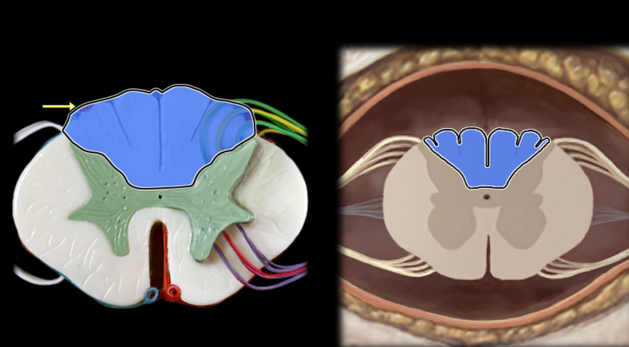 <p>Dorsal funiculus</p>