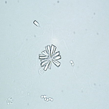 <p>What do you see in this image? What can it indicate?</p>